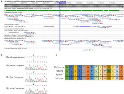 A Missense Mutation rs781536408 (c.2395G>A) of TYK2 Affects Splicing and Causes Skipping of Exon18 in vivo